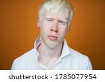 albinism Sad albino man white skin hair studio dressed t-shirt isolated yellow background. abnormal deviations. unusual appearance. skin abnormality Beautiful people with  special appearance. 