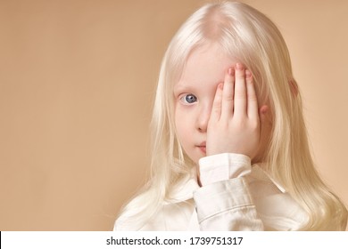 Albino. Cute caucasian little girl with albinism syndrome, she closed one eye and look at camera. natural beauty and people diversity concept