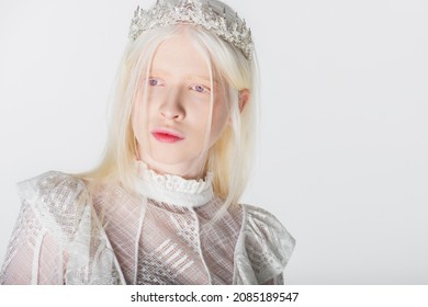 Albino Model In Blouse And Crown Looking Away Isolated On White