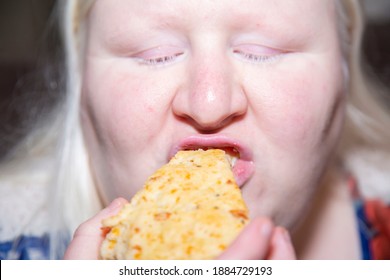 Albino Woman Eating A Bacon And Cheese Scone