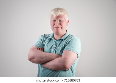 Albino young man portrait. Blond guy isolated at white background. Albinism, pale skin.
