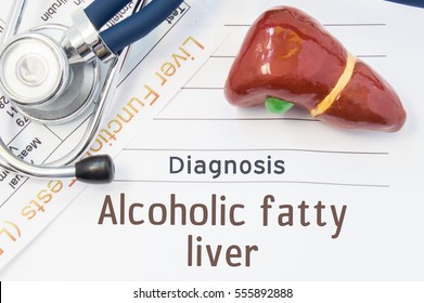 Alcoholic Fatty Liver Diagnosis. Anatomical 3D Model Of Human Liver Is Near Stethoscope, Results Of Laboratory Tests Of Liver Function And Printed On Notepad Diagnosis Of Alcoholic Fatty Liver