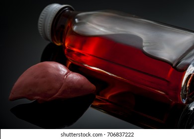 Alcoholic Liver Damage And Cirrhosis Concept With A Liver Next To A Flask Of Alcohol. Cirrhosis Is Most Commonly Caused By Alcoholism, Hepatitis B Or C Or Non-alcoholic Fatty Liver Disease