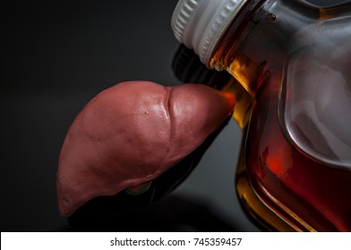 Alcoholic Liver Damage And Cirrhosis Concept With A Liver Next To A Flask Of Alcohol. Cirrhosis Is Most Commonly Caused By Alcoholism, Hepatitis B Or C Or Non-alcoholic Fatty Liver Disease