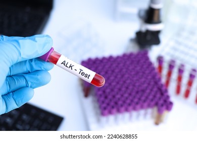 ALK test to look for abnormalities from blood,  blood sample to analyze in the laboratory, blood in test tube