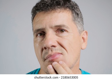 Allergic Reaction To A Bee Sting. An Unshaven Man Was Stung By A Bee And Touches His Face In The Stung Area Close-up. Edema, Swelling Of The Lower Lip