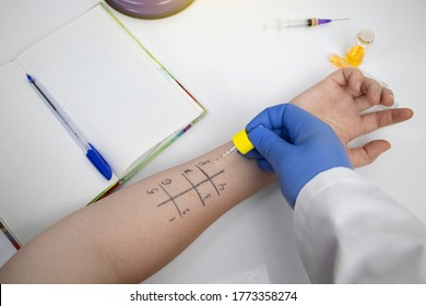 An Allergist Doctor In The Laboratory Conducts A Prik Allergy Test. Skin Test For Household, Food, Epidermal Allergic Reactions