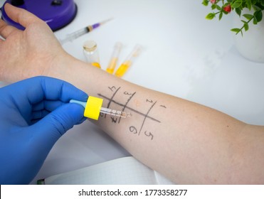 An Allergist Doctor In The Laboratory Conducts A Prik Allergy Test. Skin Test For Household, Food, Epidermal Allergic Reactions