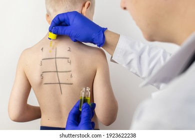 An Allergist In The Laboratory Conducts An Allergy Prick-test. Skin Test For Household, Food, Epidermal Allergic Reactions. The Test Is Performed On The Patient's Back. Child At A Doctor's Appointment