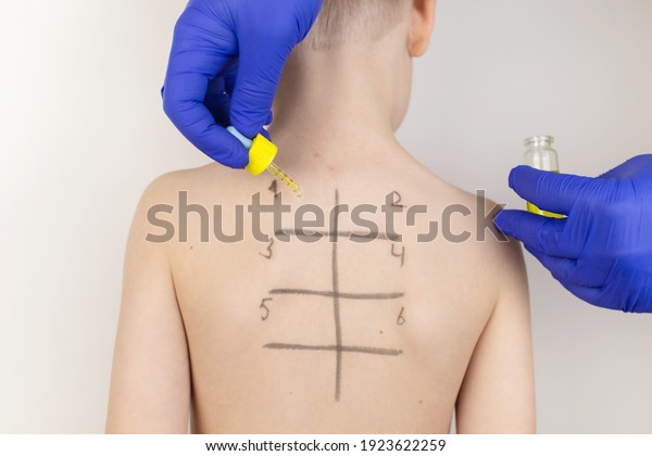 An allergist in the laboratory conducts an\
allergy prick-test. Skin test for household, food, epidermal\
allergic reactions. The test is performed on the patient\'s back.\
Child at a doctor\'s\
appointment