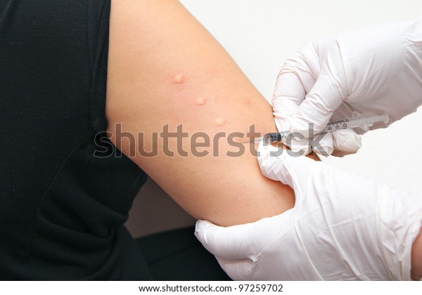 Allergy Skin\
Test