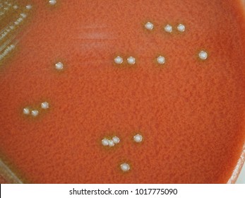 557 Hemolysis Stock Photos, Images & Photography | Shutterstock