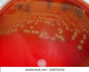 Alpha Hemolysis On Blood Agar Plate Of Streptococcus Pneumoniae