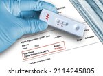 Alpha-Fetoprotein (AFP) positive test result by using rapid testing device. AFP test aids in the diagnosis of liver cancer or developing fetus for risk of birth defects and genetic disorders. 