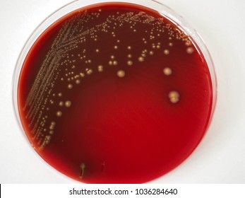Alpha-hemolysis characteristic of Streptococcus pneumoniae on the blood agar plate.