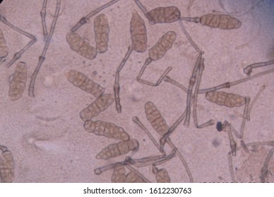 Alternaria Spore Was Zoom By Transmission Electron Microscope. Alternaria Is A Genus Of Ascomycete Fungi. Alternaria Species Are Known As Major Plant Pathogens.  