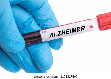 Alzheimer. Alzheimer Disease Blood Test In Doctor Hand