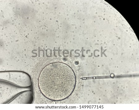 Amazing macro view through the microscope at process of the in vitro fertilization of a female egg inside IVF dish in the laboratory. Horizontal.