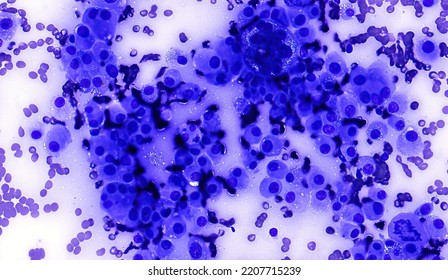 Amelanotic melanoma cytology from dog aspirate - Shutterstock ID 2207715239