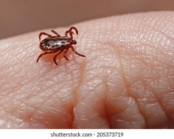 American Dog Tick (Dermacentor Variabilis) Also Known As Wood Tick Walking On Human Skin