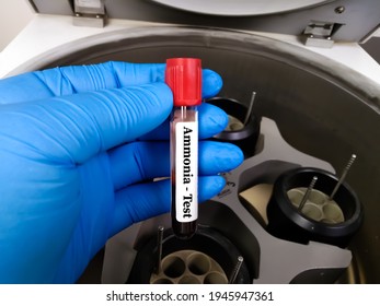 Ammonia Level Blood Test For Hepatic Encephalopathy Reye Syndrome Or Urea Cycle Disorders