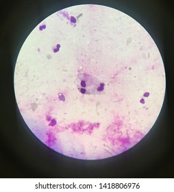 Amoeba is a genus of single-celled amoeboids in the family Amoebidae. Entamoeba is an opportunistic Amoebozoa. Stock Photo