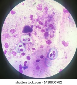 Amoeba is a genus of single-celled amoeboids in the family Amoebidae. Entamoeba is an opportunistic Amoebozoa. Stock Photo