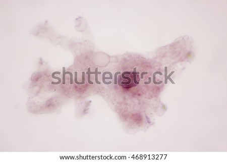Amoeba proteus in the microscopic view