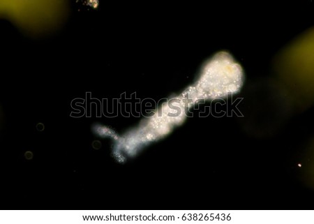 Amoebae move and feed by using pseudopods, which are bulges of cytoplasm formed by the coordinated action of actin microfilaments pushing out the plasma membrane that surrounds the cell.