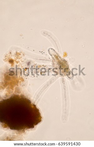 Amoebae move and feed by using pseudopods, which are bulges of cytoplasm formed by the coordinated action of actin microfilaments pushing out the plasma membrane that surrounds the cell.