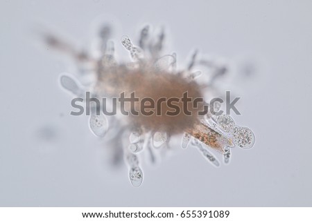 Amoebae move and feed by using pseudopods, which are bulges of cytoplasm formed by the coordinated action of actin microfilaments pushing out the plasma membrane that surrounds the cell.
