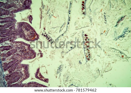 amoebic dysentery under the microscope