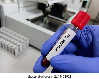 Amoxicillin Test: A Penicillin Type Antibiotic Used To Treat A Wide Variety Of Bacterial Infections.