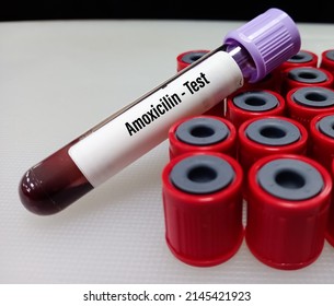 Amoxicillin Test: A Penicillin Type Antibiotic Used To Treat A Wide Variety Of Bacterial Infections.