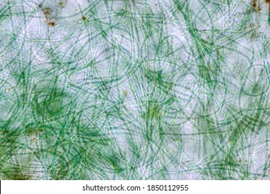 Anabaena Is A Genus Of Filamentous Cyanobacteria On Slide Under The Microscope For Education.