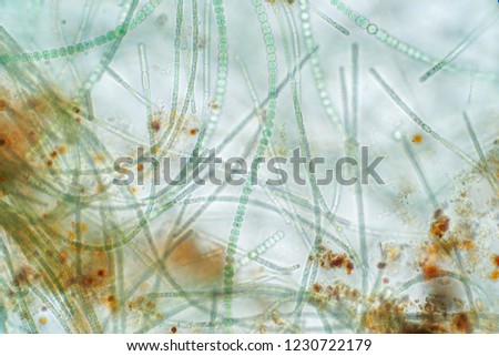 Anabaena is a type of algae under the microscopic.