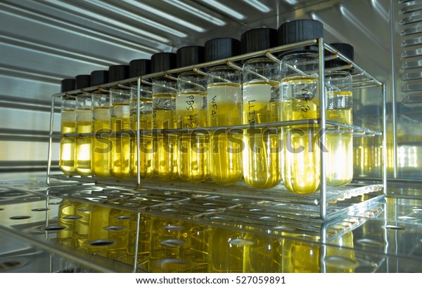 Anaerobic Bacteria Culture Isolation Bacterial Culture Stock Photo