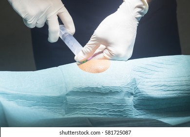 2,346 Joint injection Images, Stock Photos & Vectors | Shutterstock