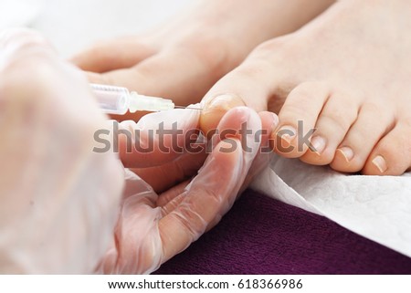 Analgesic injection.  The doctor injects an analgesic drug into the woman's toe. 