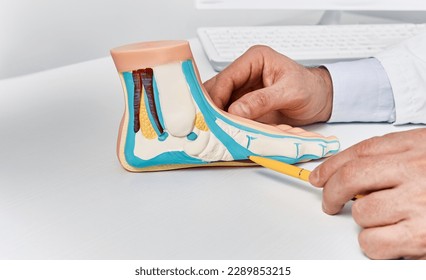 Anatomical flat foot model on doctor table while consultation in orthopedics center. Treatments for flat feet and pes planus - Powered by Shutterstock