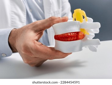 Anatomical lumbar disc herniation model in doctor hand while consultation in medical clinic. Intervertebral hernia treatment