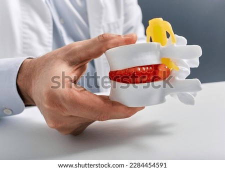 Anatomical lumbar disc herniation model in doctor hand while consultation in medical clinic. Intervertebral hernia treatment