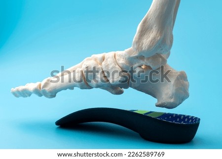 Anatomical model of the bones of the human foot wearing an orthopedic insole concept for Metatarsal health and treatment, Posture correction methods and Skeletal alignment improvement
