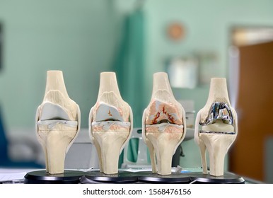 11,079 Osteoarthritis Knee Images, Stock Photos & Vectors | Shutterstock