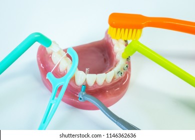 Anatomical Realistic Plastic Dental Teeth Model With Different Types Of Tooth Cleaning Tools. Toothbrush, Interdental Brushes And Floss.