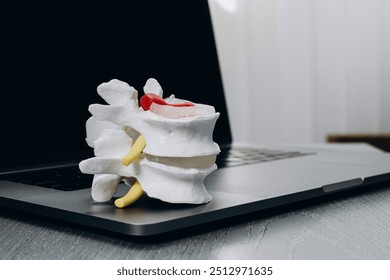  Anatomical spine model on a physiotherapist's desk next to a laptop. Perfect for illustrating modern spinal assessments and treatment planning with advanced technology. - Powered by Shutterstock