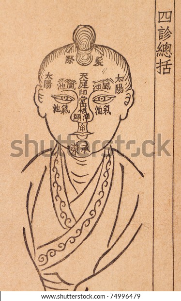 Ancient Chinese Medical Books