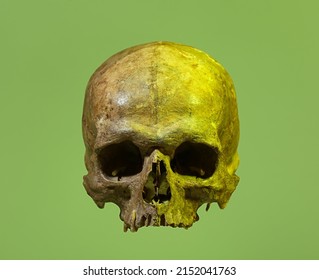 Ancient Human Skull On Color Background