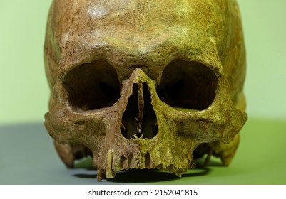 Ancient Human Skull On Color Background