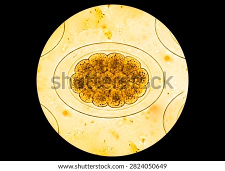 Ancylostoma spp or Hook worm eggs of pasasite in stool examination.